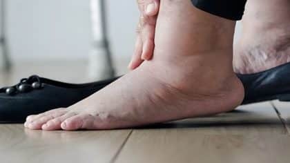 Quelles sont les maladies qui entraînent un gonflement des pieds ?