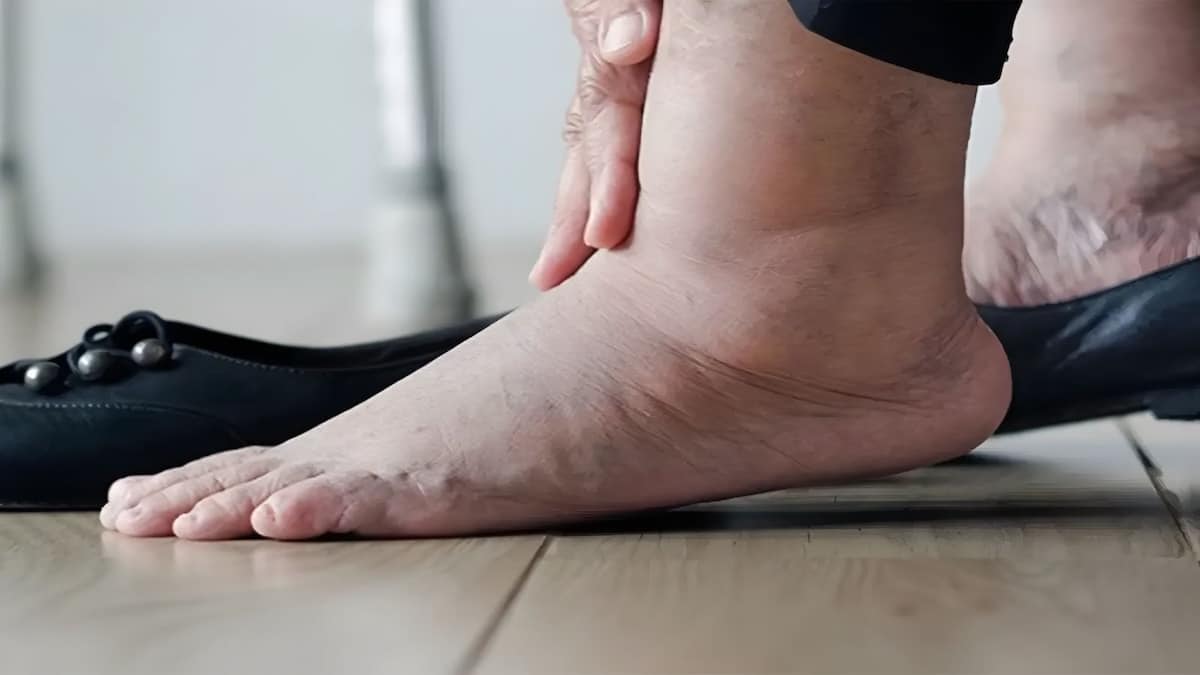 Quelles sont les maladies qui entraînent un gonflement des pieds ?