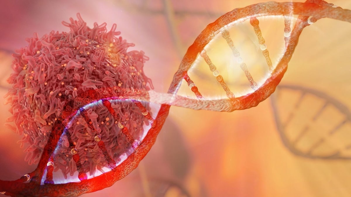 Cancer : signes révélateurs et origines