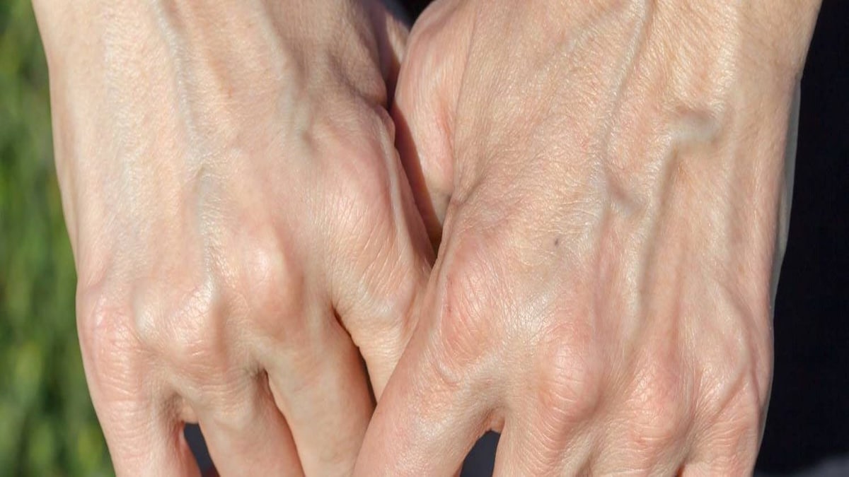 Pourquoi certaines veines ressortent davantage chez certaines personnes